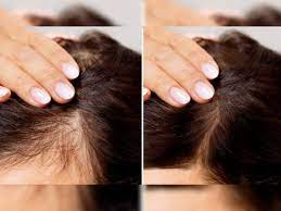 मजबूत स्कैल्प की देखभाल के लिए अपनाएं ये घरेलू टिप्स