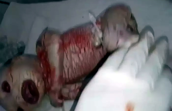 मध्य प्रदेश : महिला ने दिया एलियन जैसे दिखने वाले बच्चे को जन्म, लोग हुए हैरान 