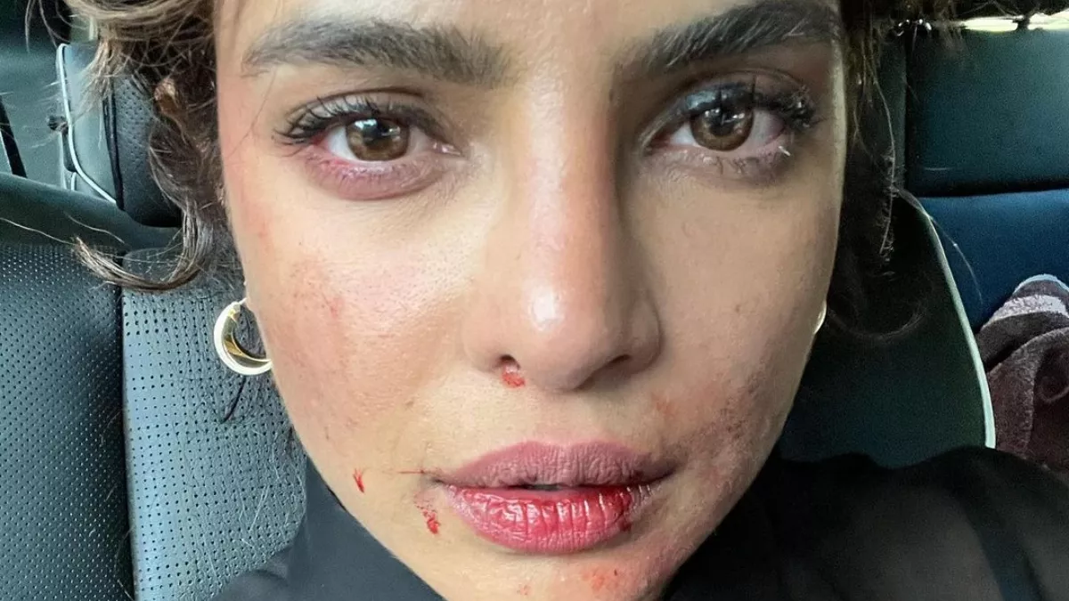 शूटिंग के दौरान एक्ट्रेस प्रियंका को लगी चोट