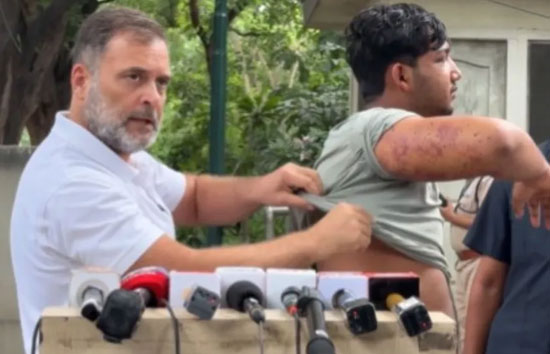 'भाई को लगी गोली ', राहुल बोले- शिक्षा मंत्री को जाना होगा