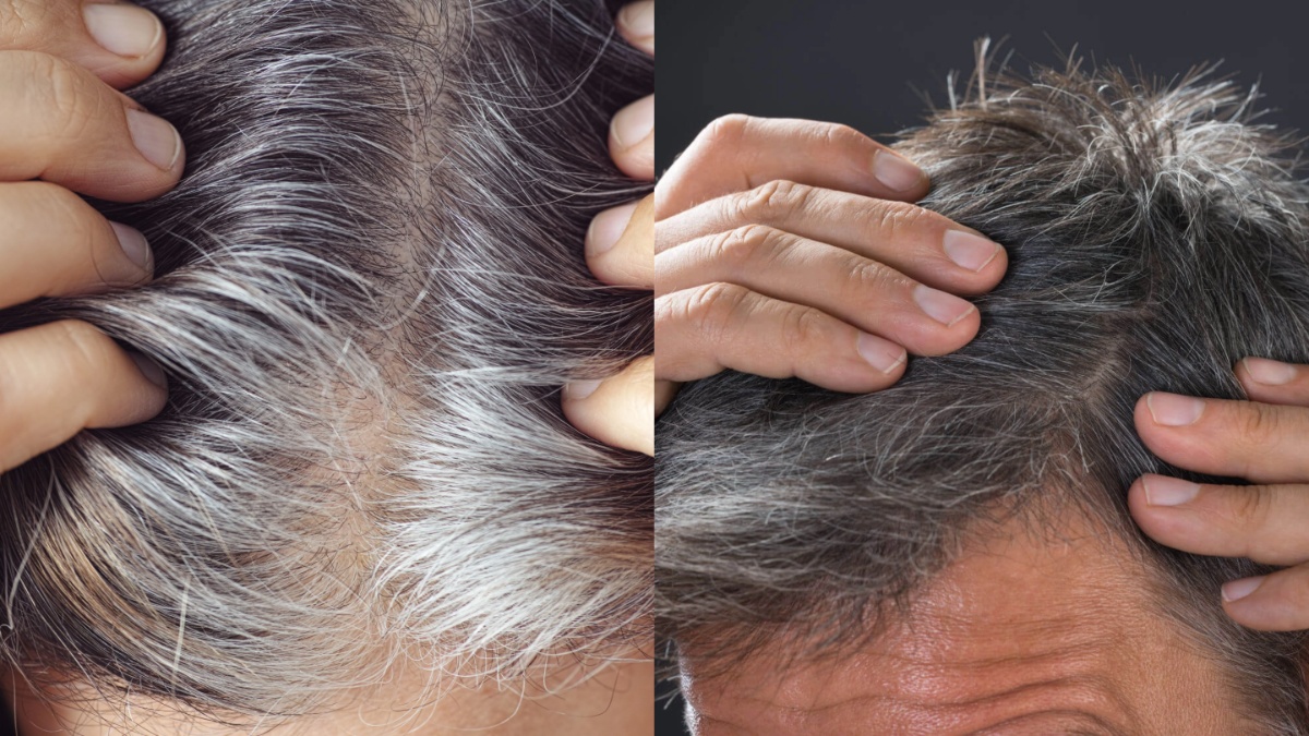 Grey Hair से आप भी हैं परेशान तो करें ये काम 