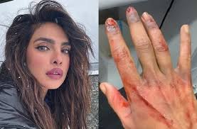 Priyanka Chopra ने सेट से शेयर की खून में लथपथ तस्वीर, फिल्म की शूटिंग हुई पूरी
