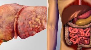 लिवर की बीमारियों का खतरा तेजी से फैलाती ये आदतें 