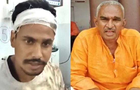 यूपी : युवक से मारपीट मामले में बलिया के पूर्व बीजेपी विधायक और बेटे समेत 7 पर मुकदमा 