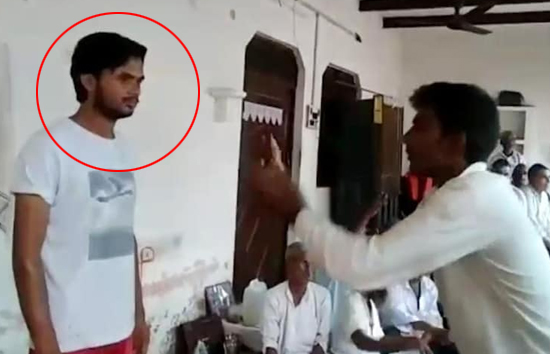 आगरा : युवक को 15 दिन 8 बार सांप ने काटा, आंखो से दिखना हुआ कम