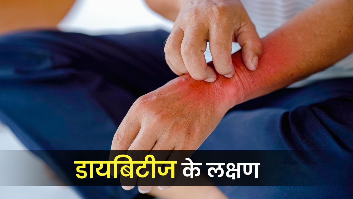 त्वचा पर नजर आने वाले ये 5 लक्षण देते हैं Diabetes का संकेत