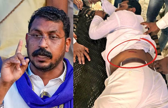 भीम आर्मी प्रमुख चंद्रशेखर पर हमला करने वाले चार गिरफ्तार, सरेंडर करने की कर रहे थे तैयारी 