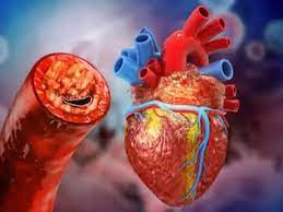 Heart Blockage की ओर इशारा करते हैं ये लक्षण